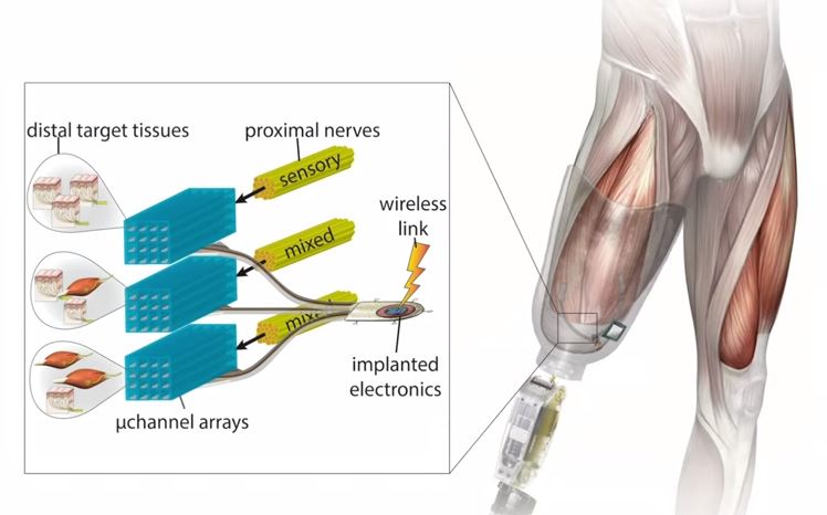 Bionic knee joint